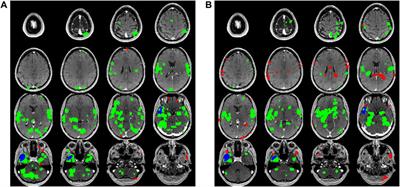 No change in network connectivity measurements between separate rsfMRI acquisition times